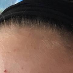 Thumbnail of post image