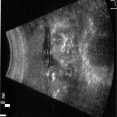 Thumbnail of post image