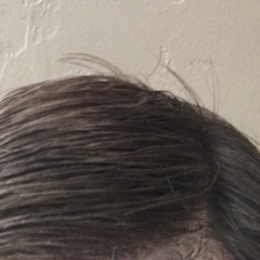 Thumbnail of post image